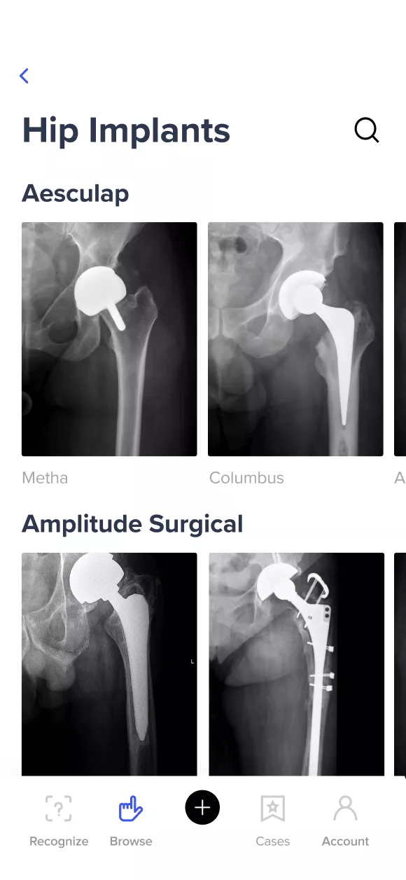 Img Case AIdentify B