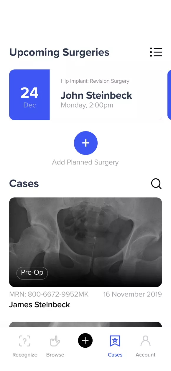 Img Case AIdentify A
