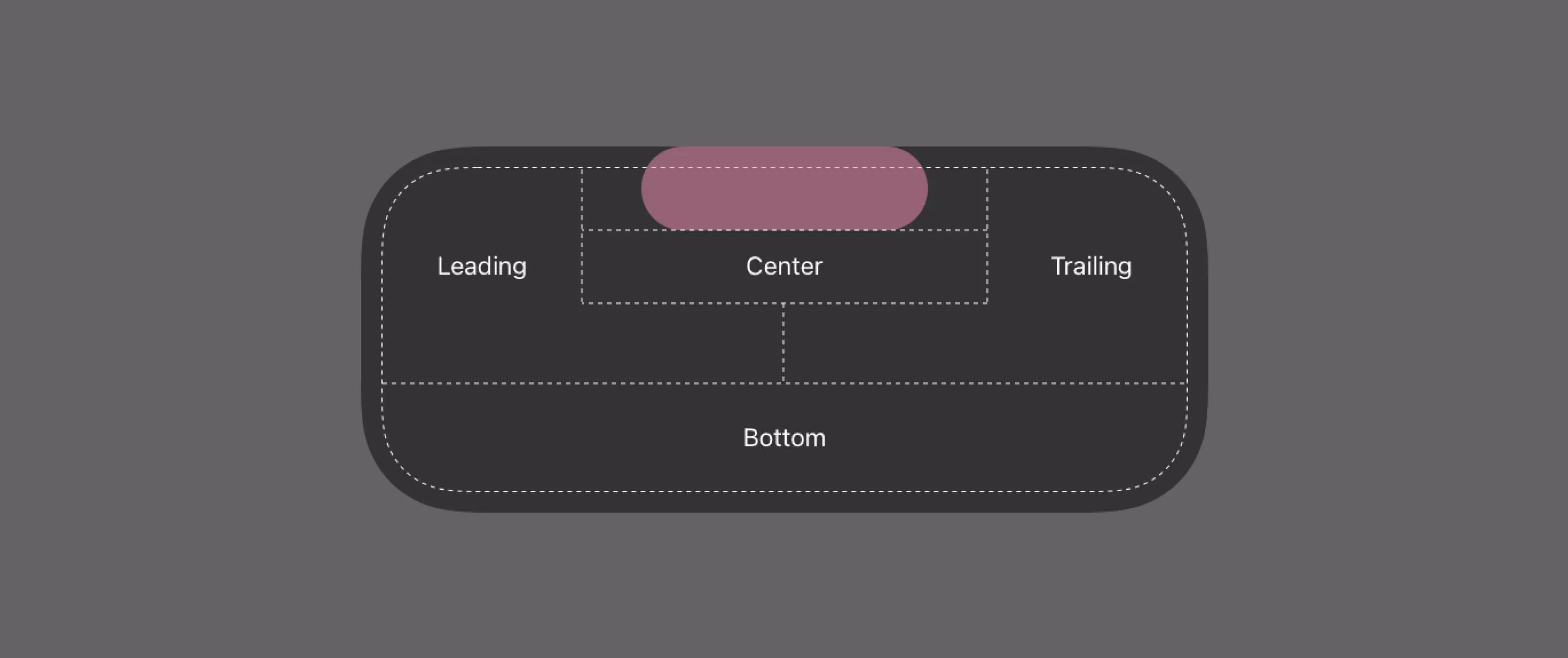 iOS Live Activity Expanded view